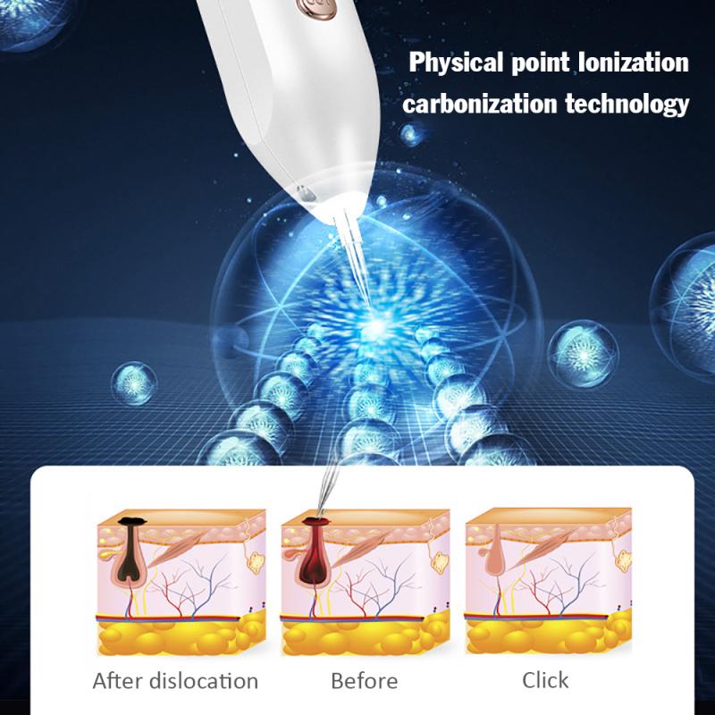 Plasma Pen Fibroblast Laser Pen – Mole Removal Precision