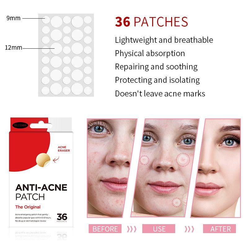 Acne Patch (36 Patches) – Water Gel Transparent Invisible Hydrocolloid Pimple Stickers