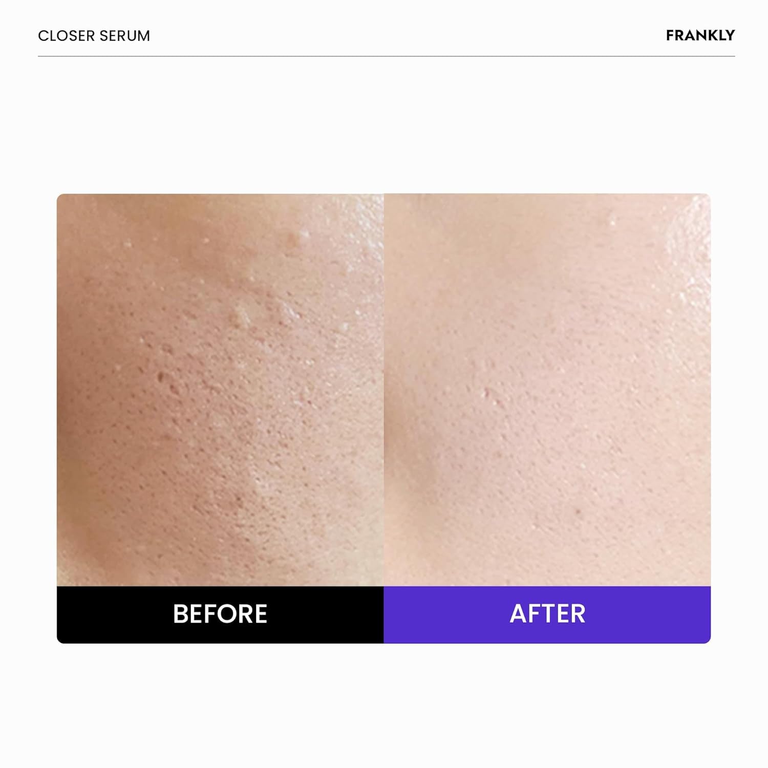 FRANKLY Closer Pore Reducing Serum – 100ml | Pore-Minimizing, Firming & Radiance-Boosting K-Beauty Serum