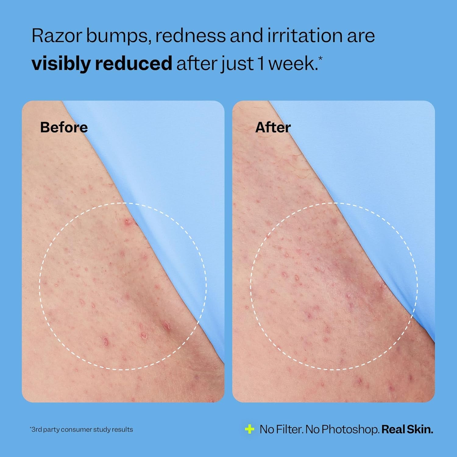 Peach Slices Smoothing Solution Ingrown Hair Treatment – 50ml | Clear Bumps, Soothe Redness & Brighten Dark Spots