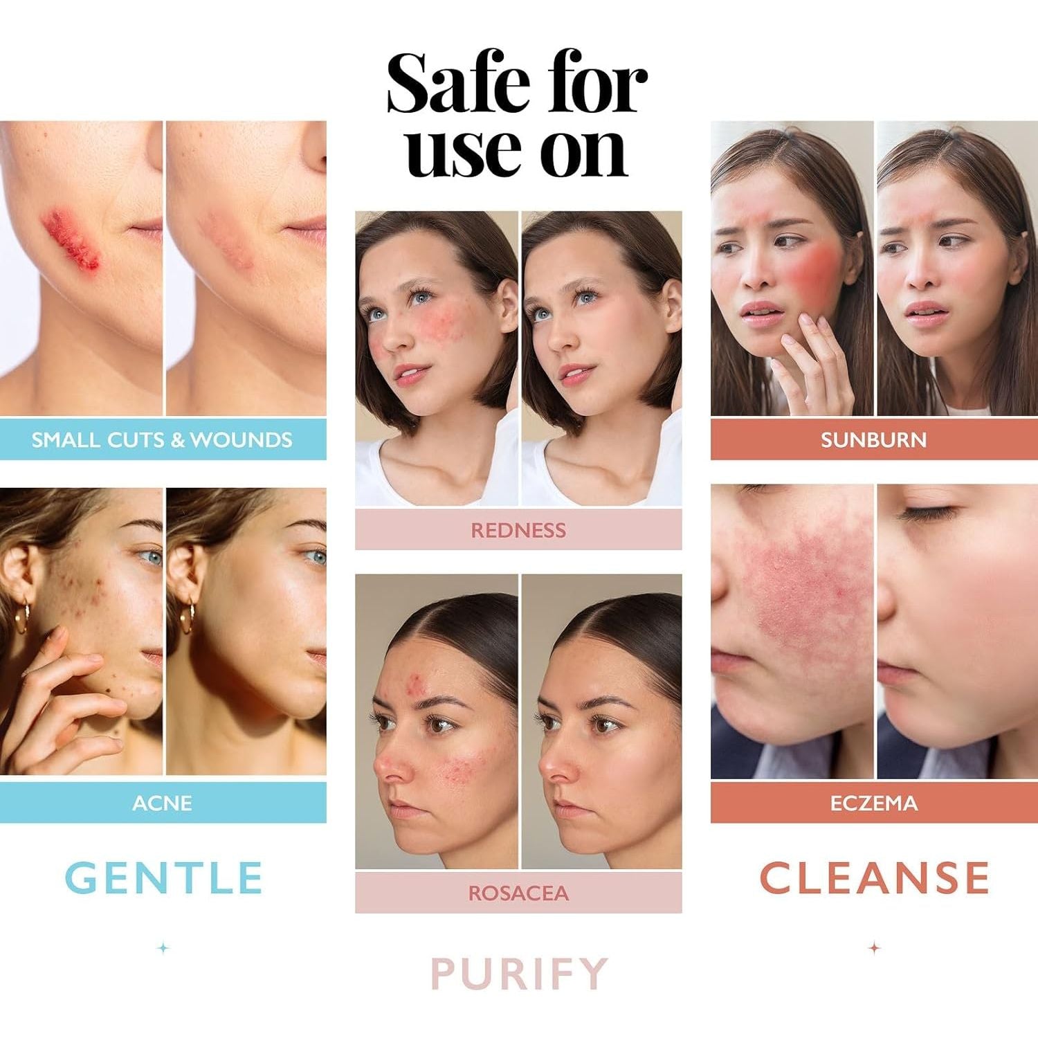 Aquia Hypochlorous Acid Spray - 237ml