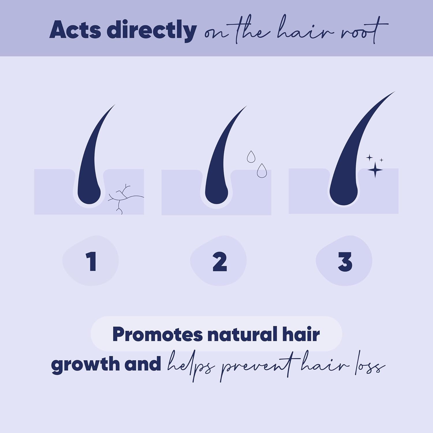 MOERIE Ultimate Hair Growth Serum – 50ml | Natural Regrowth & Thickening Treatment | Biotin, Caffeine & Amino Acids for Women
