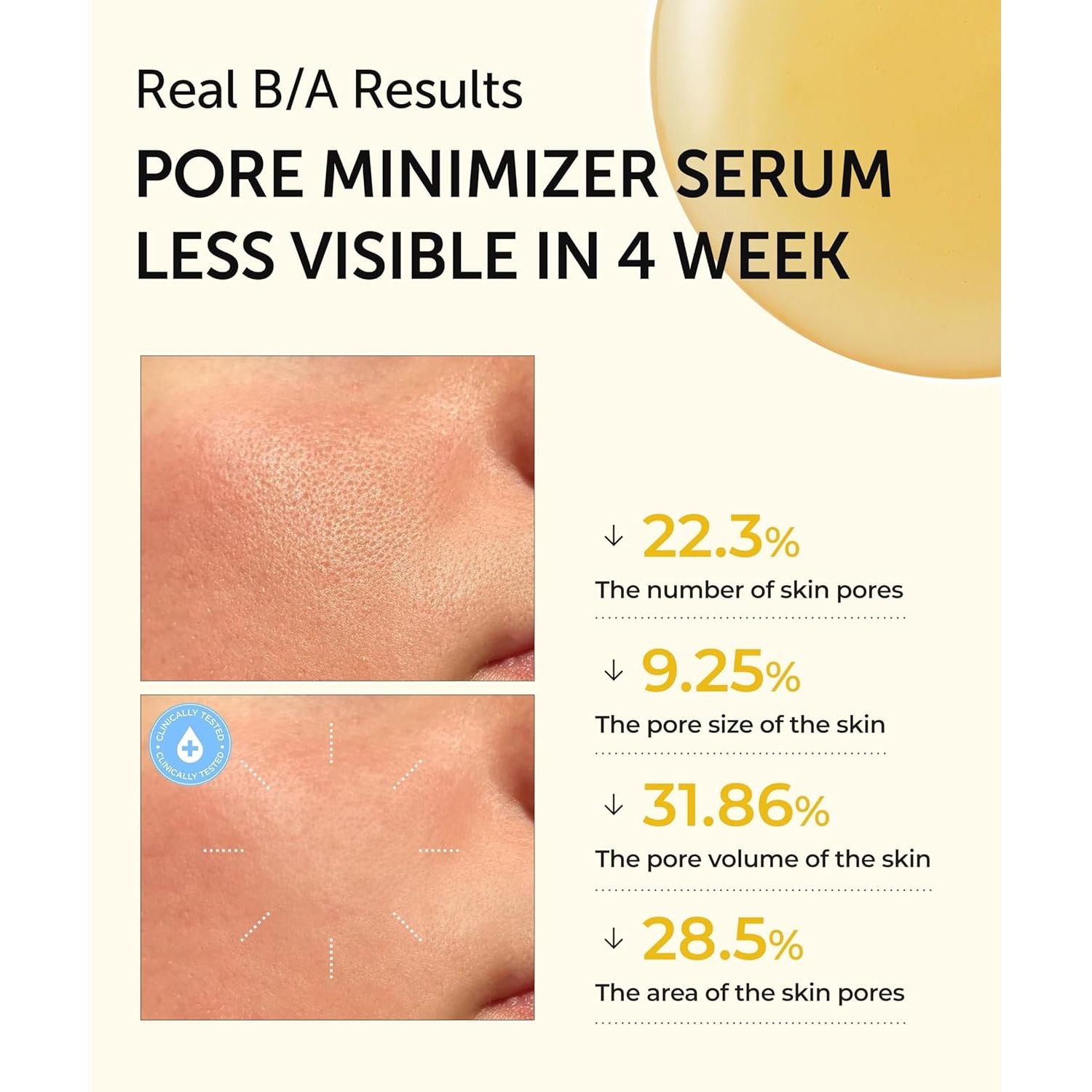 SERUMKIND Pore Tightening and Refining Serum Korean Face Skincare - Natural Salicylic Acid - Yellowmello Extract 92% -1 Fl.Oz.