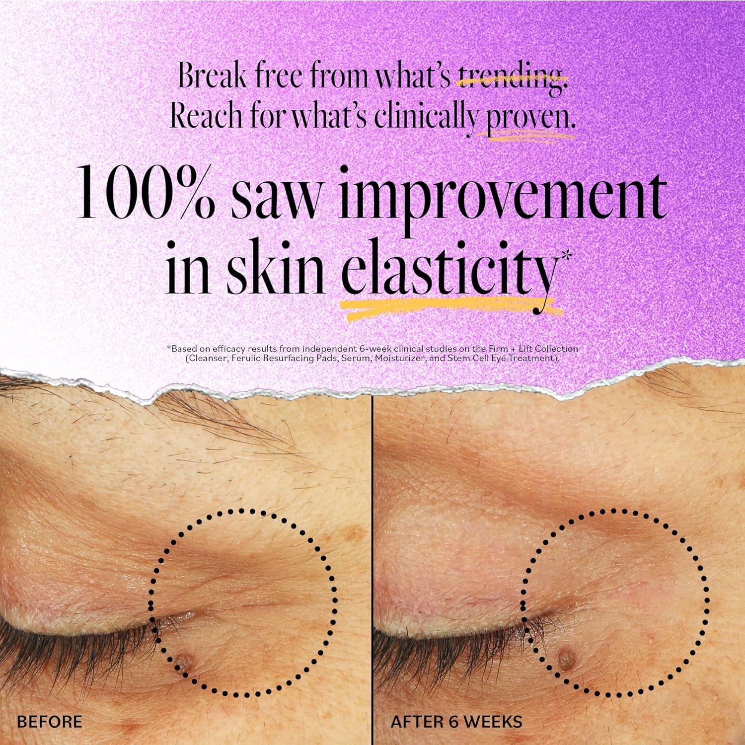 Derma E Stem Cell Eye Lifting Treatment – 14g | Firming, Lifting & Anti-Aging Eye Care