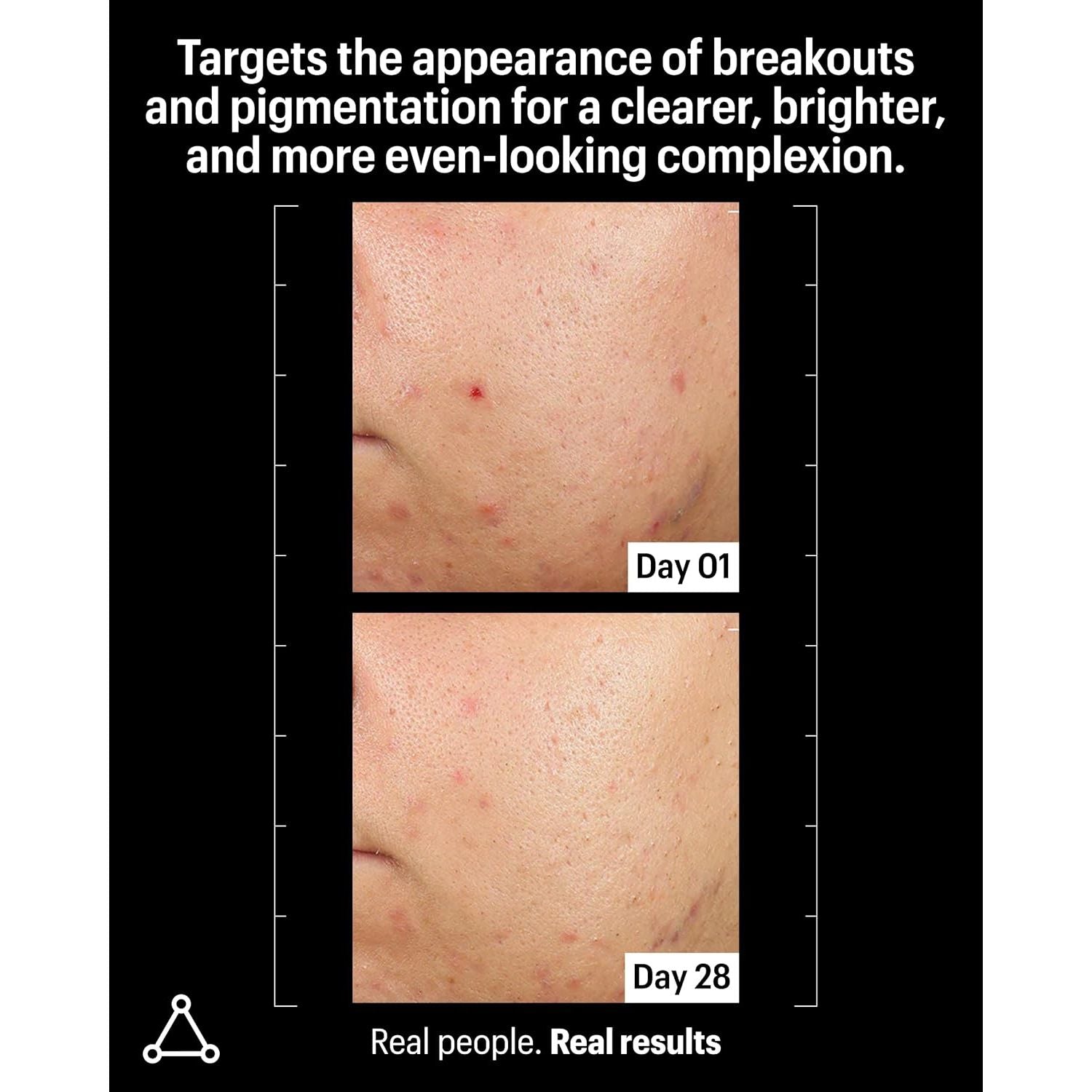 Allies of Skin Azelaic & Kojic Advanced Clarifying Serum – 30ml | 33% Clearer Skin in 1 Month
