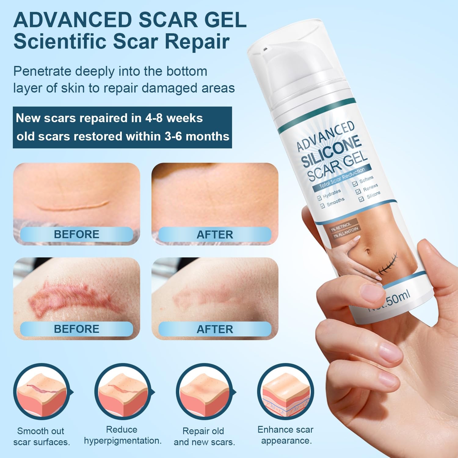 Mitgary Advanced Silicone Scar Gel - 50ml