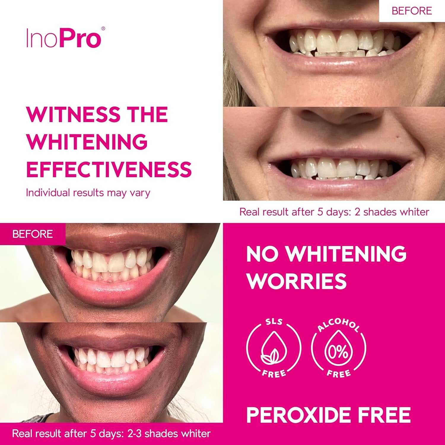 InoPro Innovative Whitening Strips – 21 Treatments (42 Strips) | Advanced Whitening, Stain Removal & Enamel Protection