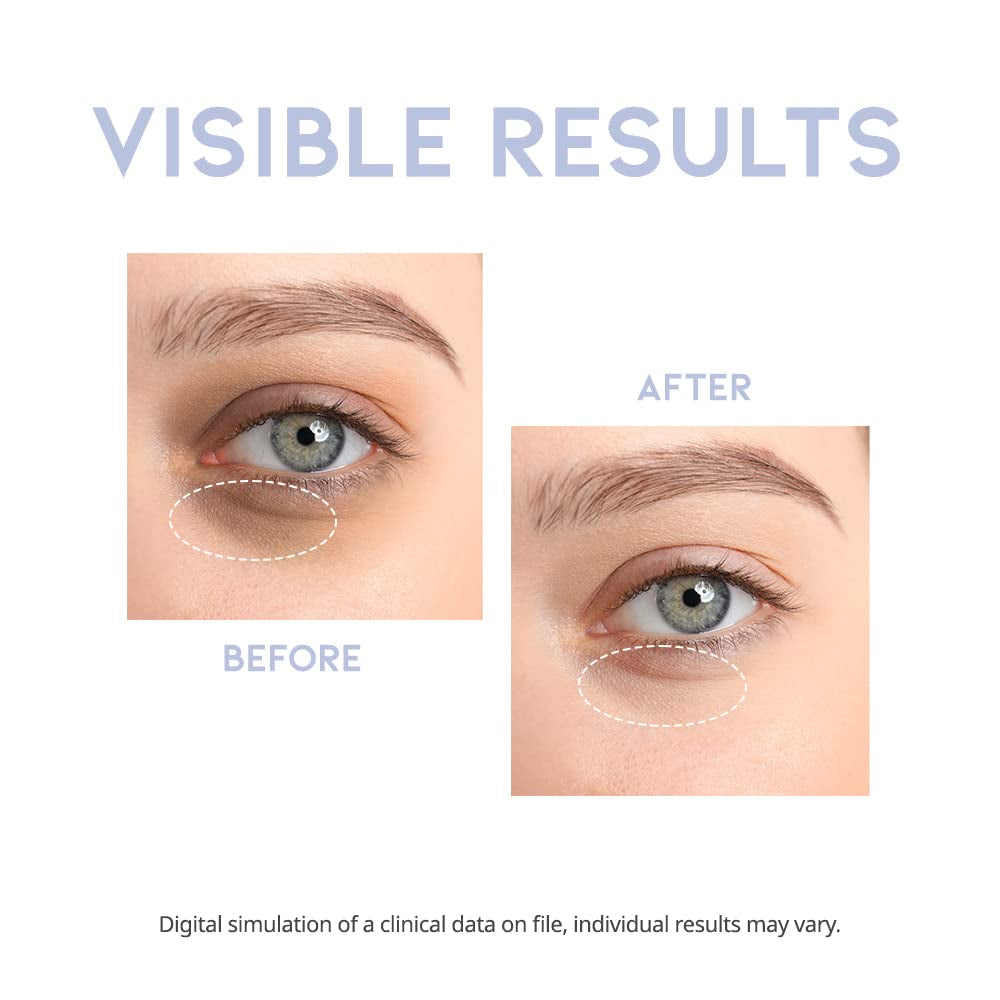 #OOTD H+ Intensive Eye Serum - 30g