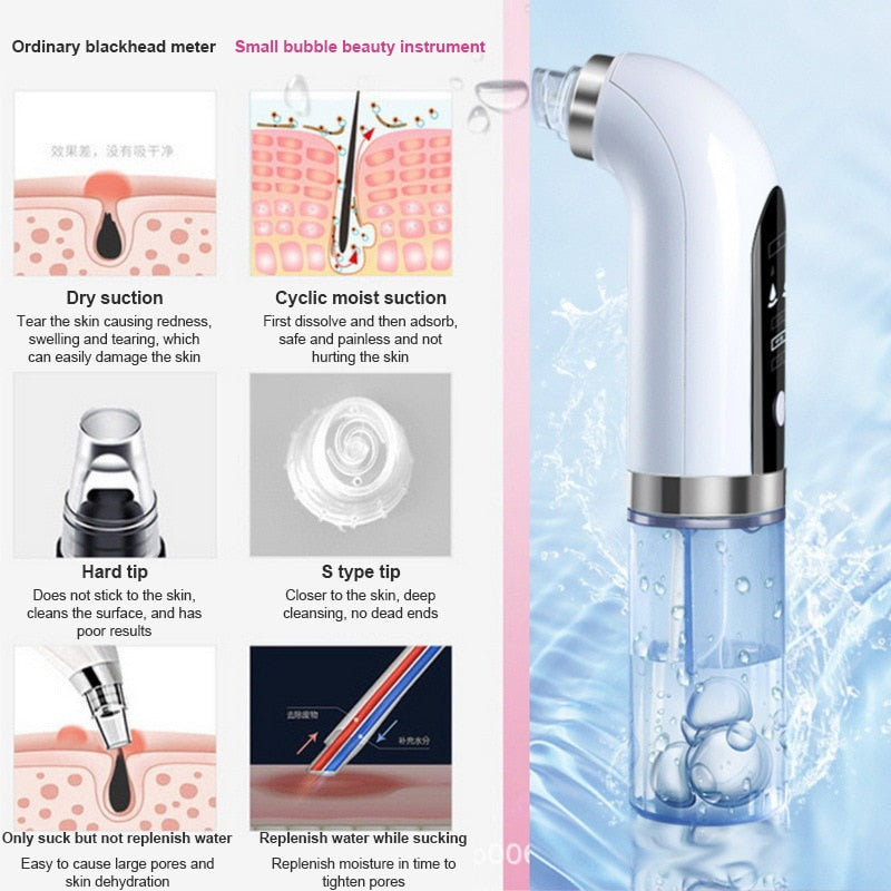 Bubble Blackhead Remover USB - Pore Cleanse Radiance
