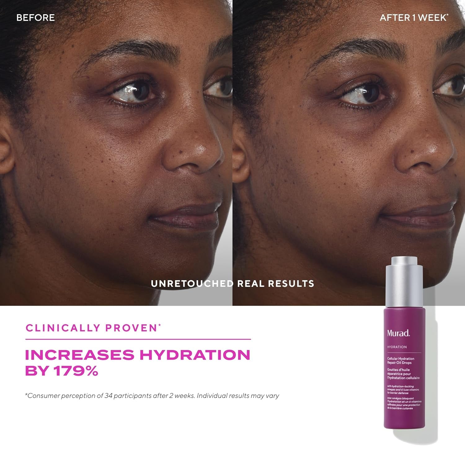 Murad Cellular Hydration Repair Oil Drops – 30ml | Fast-Absorbing Hydrating Facial Oil