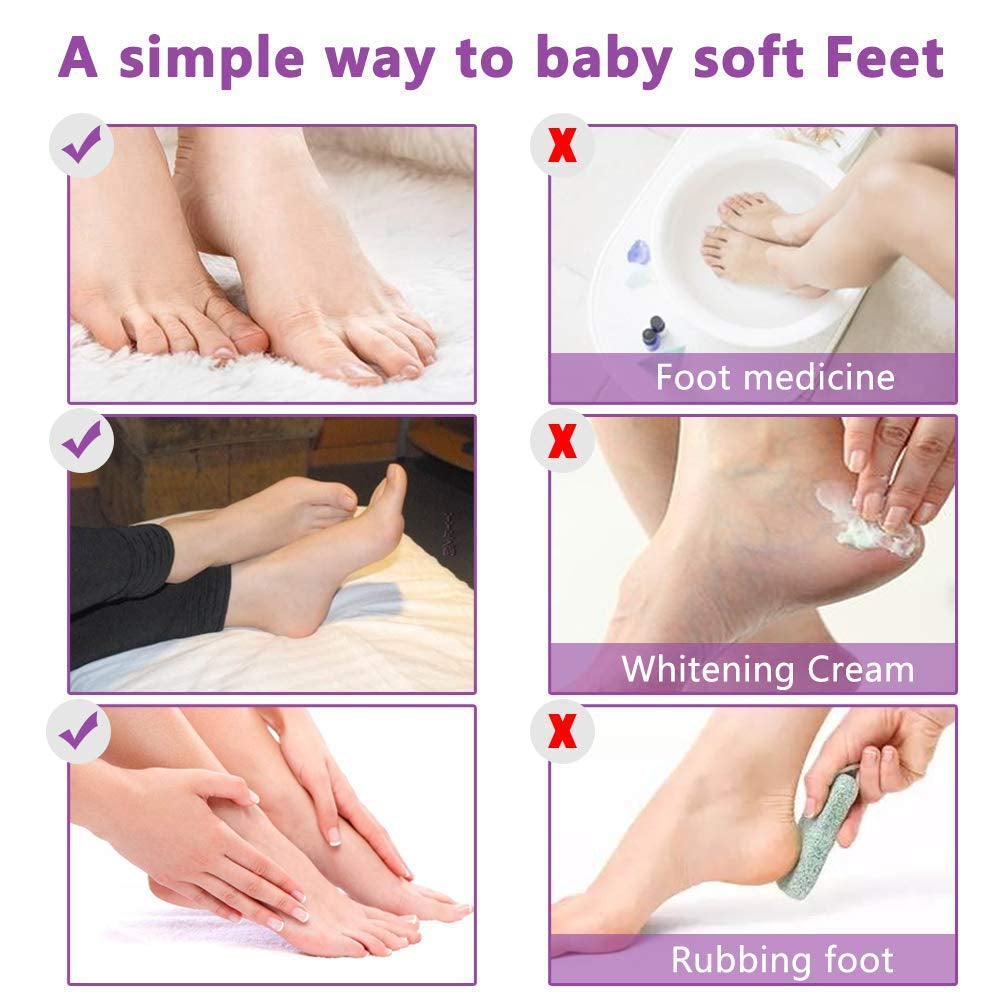 ALIVER Exfoliating Foot Mask – Lavender – 5 Pack | Peels Dead Skin for Baby-Soft Feet