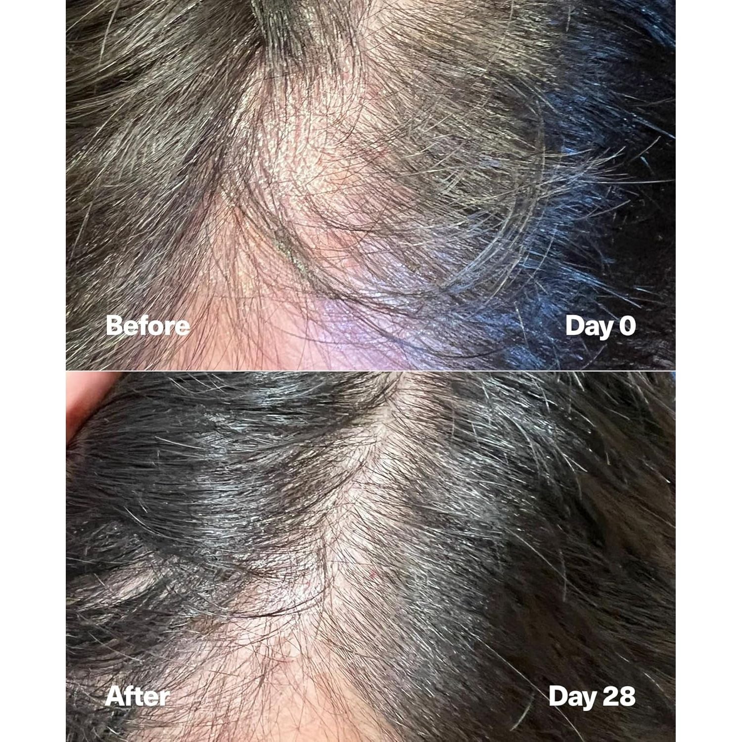SickScience Powercycle Exosome Scalp Serum – 60ml | Hair Density, Regrowth & Thicker-Looking Hair