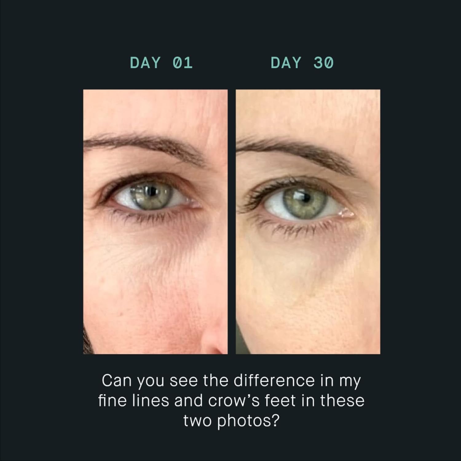 OneSkin OS-01 EYE Topical Supplement Essential Eye Cream – 20ml | Targets Fine Lines, Puffiness & Signs of Aging