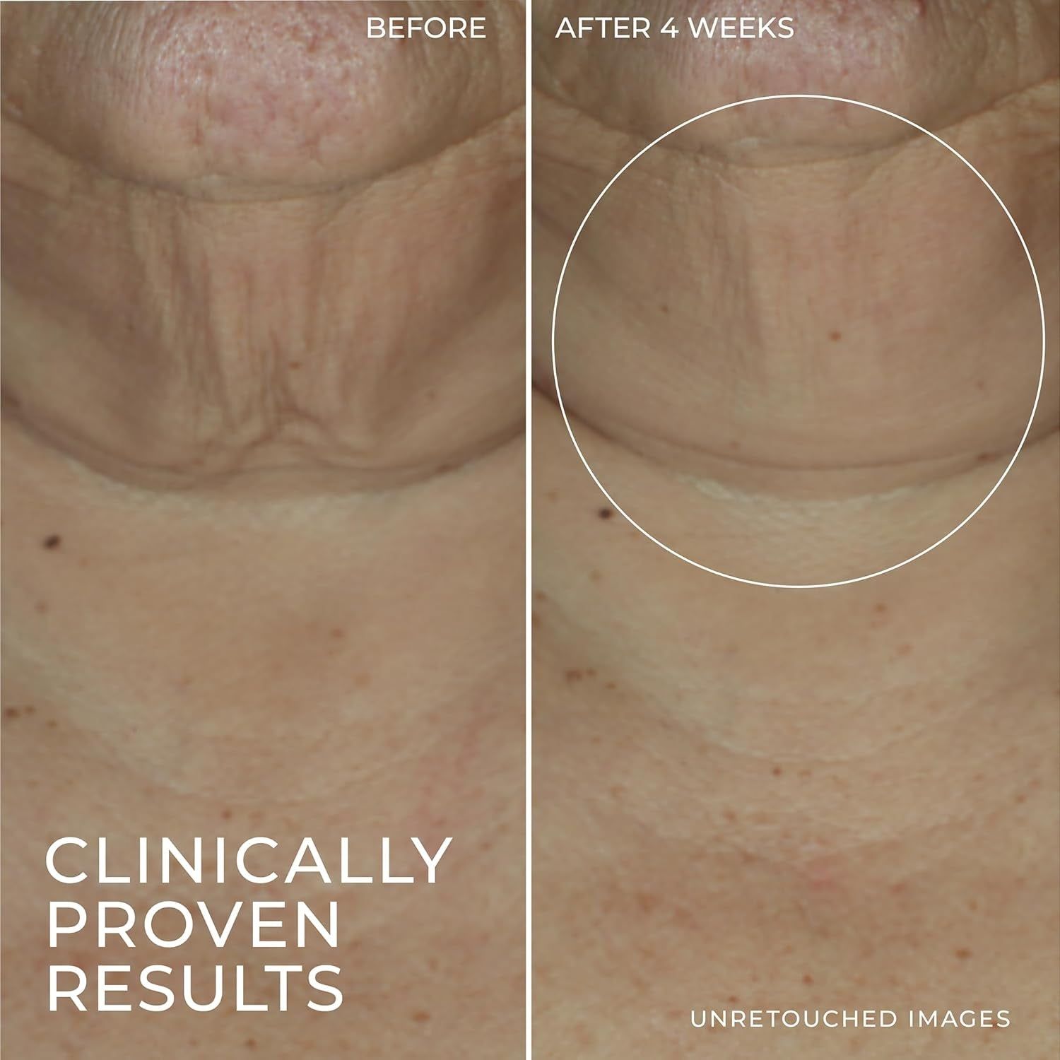 RoC + Derm Correxion Firming Serum Stick + Advanced Retinol – 30g | Lift, Tighten & Firm Skin on Face, Neck & Hands