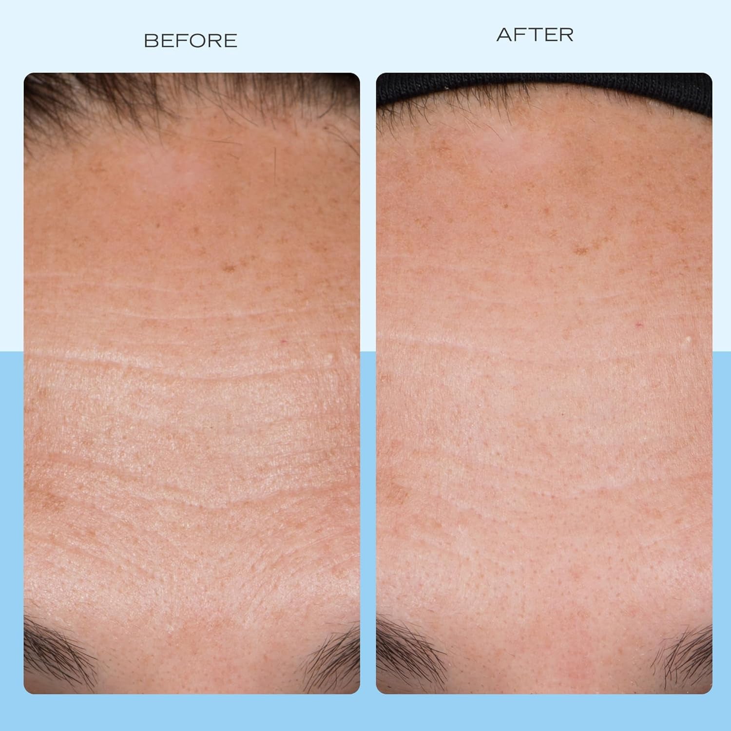 First Aid Beauty Firming Cream – 104ml | Collagen-Boosting Moisturizer for Youthful, Plump Skin