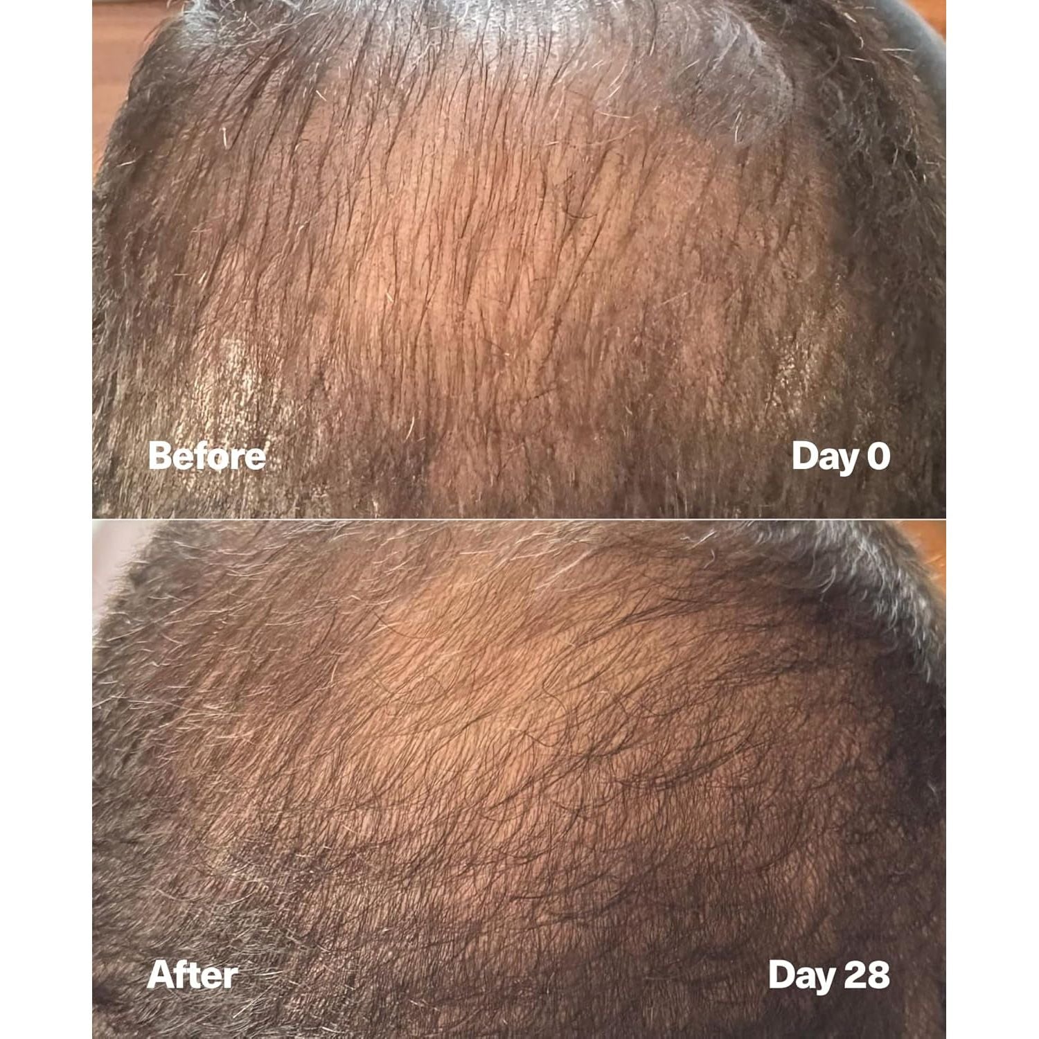 SickScience Powercycle Exosome Scalp Serum – 60ml | Hair Density, Regrowth & Thicker-Looking Hair