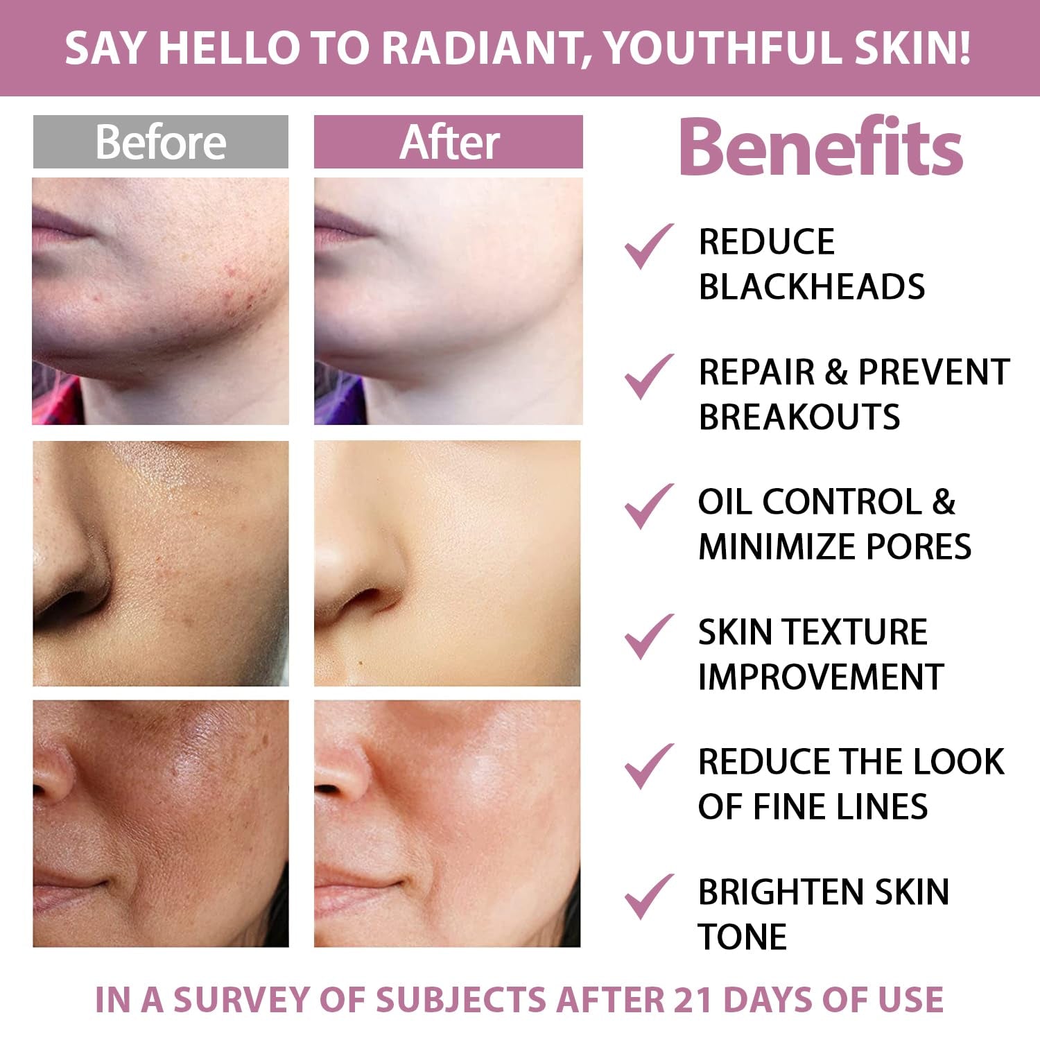 Care me Resurfacing Pads - 50 Pads