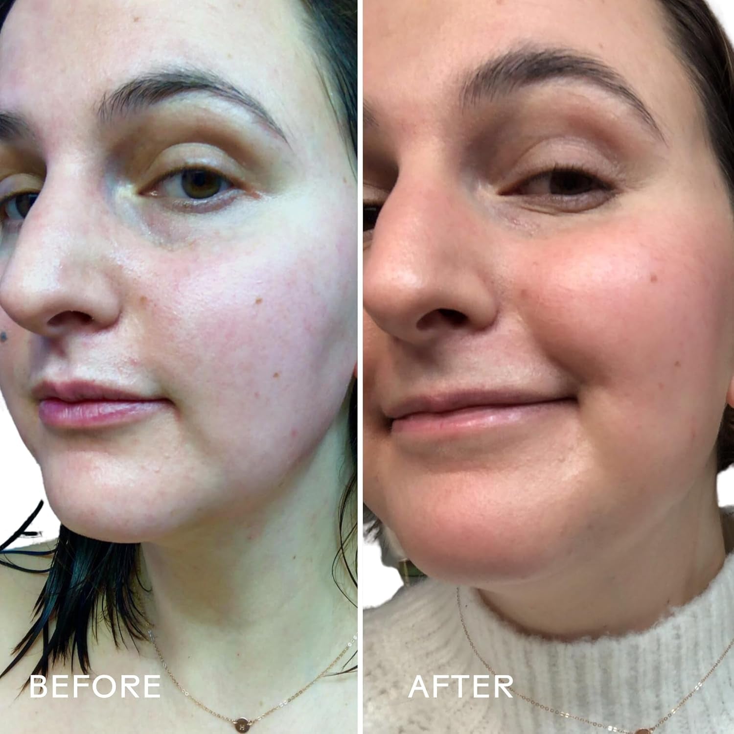 - Boost 49% Rosehip Oil Serum | Moisturize, Firm, Plump Skin | Cruelty-Free, Vegan, Paraben-Free, Sensitive Skin Safe (1 Fl Oz | 30 Ml)