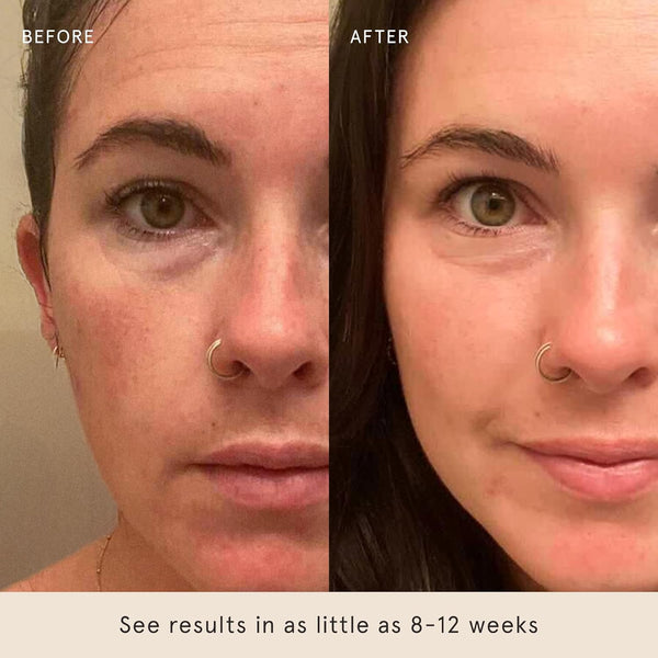 Barefaced Overachiever Serum – 30ml | 10-in-1 Skin Multitasker with Bakuchiol for Firm, Clear, Pregnancy-Safe Glow