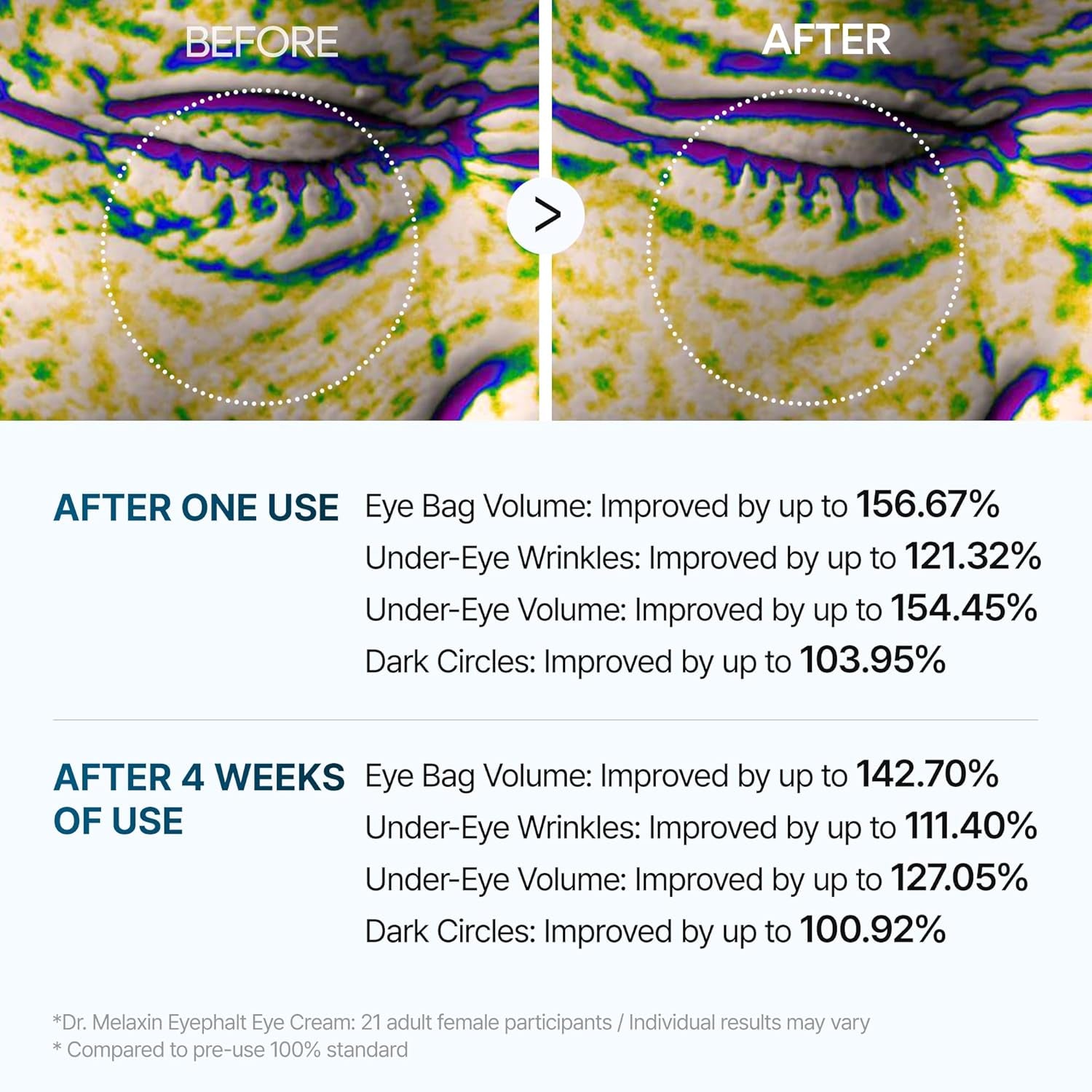 Dr.Melaxin Eyephalt EyeCream for Eyebags – 10ml | Targeted Night Repair for Puffiness & Dark Circles