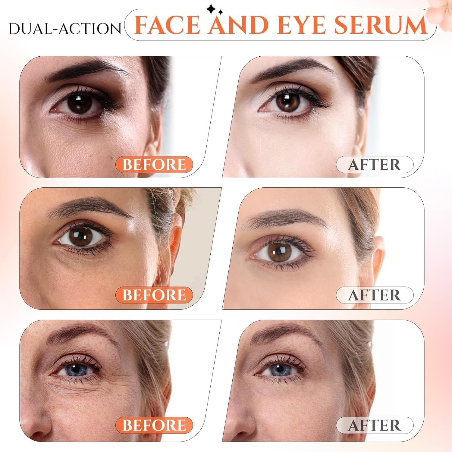 20% Vitamin C Serum, Retinol Serum for Face, Dark Spot Remover for Face, CE Ferulic Acid, Hyaluronic Acid, Hydrate & Plump Skin Care anti Aging Wrinkle Brightening Skincare -1 Fl Oz.