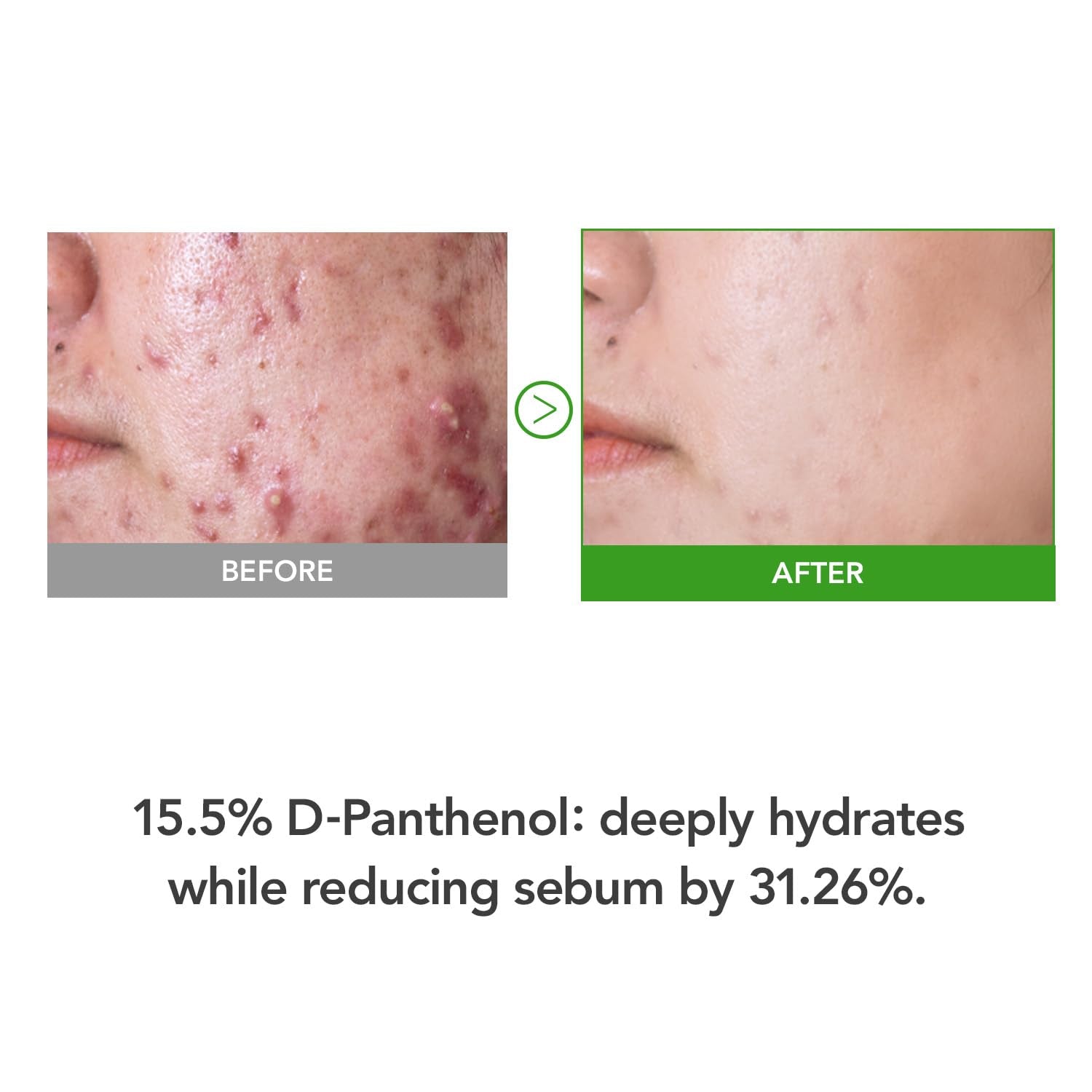 KIOSKIN  D-Panthenol 15.5 Cream - 35ml