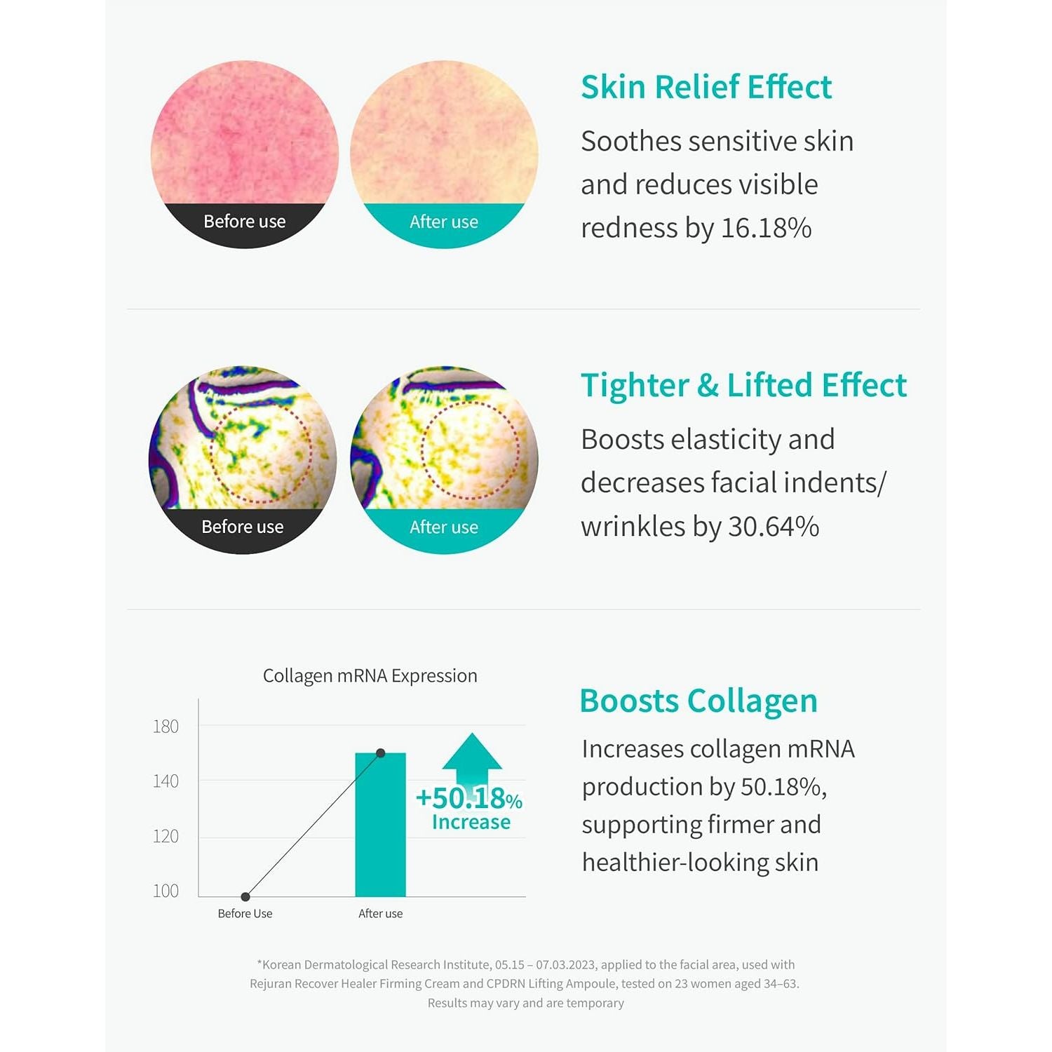 REJURAN® PDRN Recover Lifting Ampoule - 2ml X 14 Vials