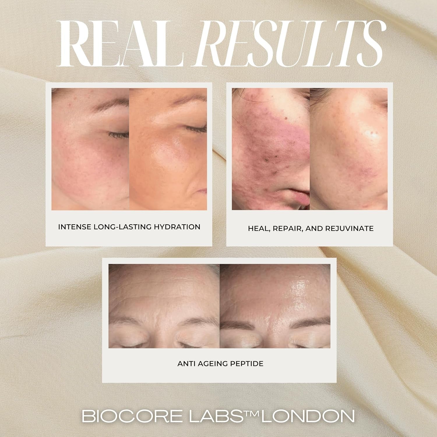 BIOCORE LABS 3-In-1 Snail Mucin Super Serum – 100ml | Hydrates, Firms & Plumps with 80% Snail Filtrate, Peptides & Hyaluronic Acid