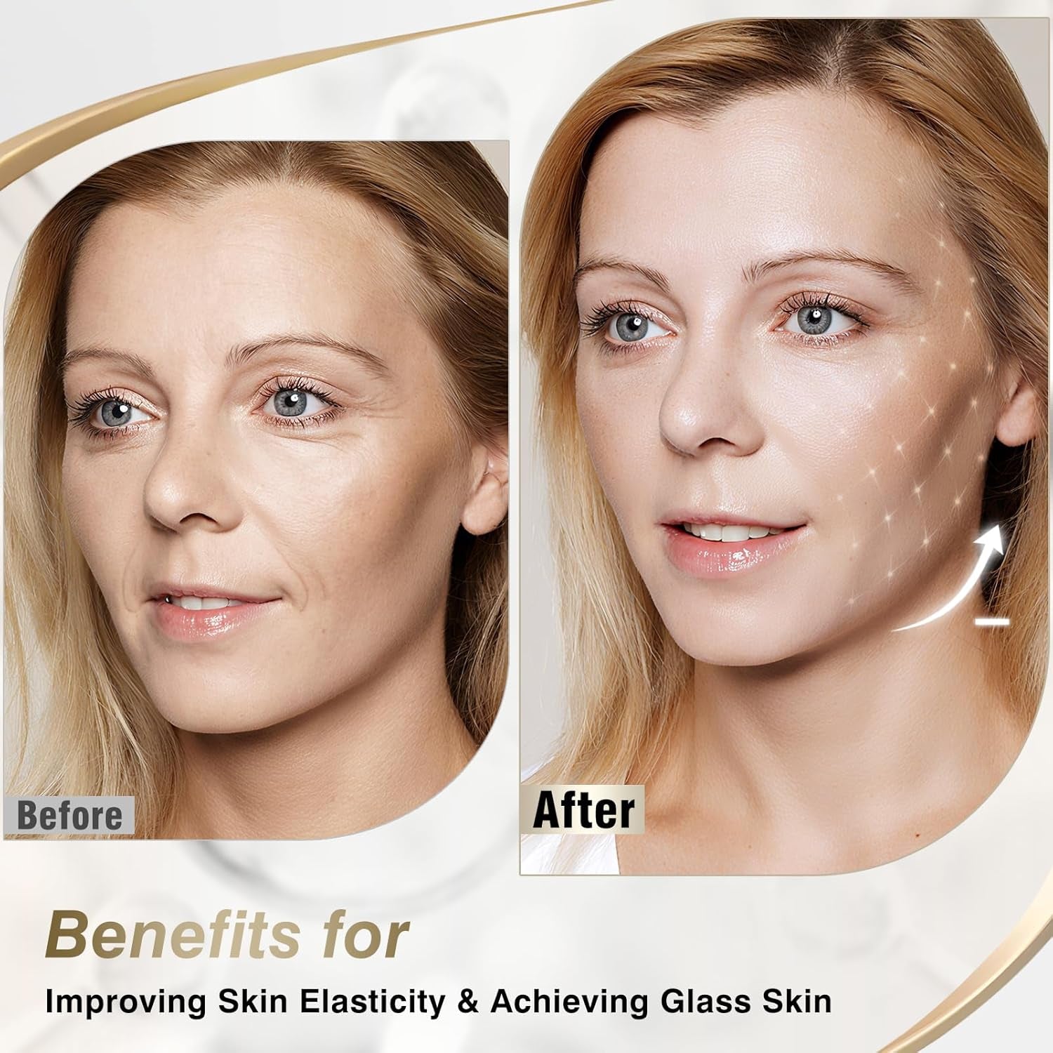 ISTON Bio-Collagen Anti-Wrinkle Gel Mask – 24g x 6 Sheets | Deep Hydration, Firming & Wrinkle Reduction