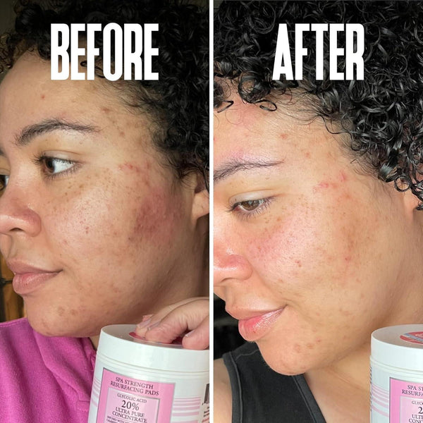 Divine Derriere Spa Strength Exfoliating Pads with Glycolic Acid 20% AHA - 50ml - Glam Global UKDivine Derriere