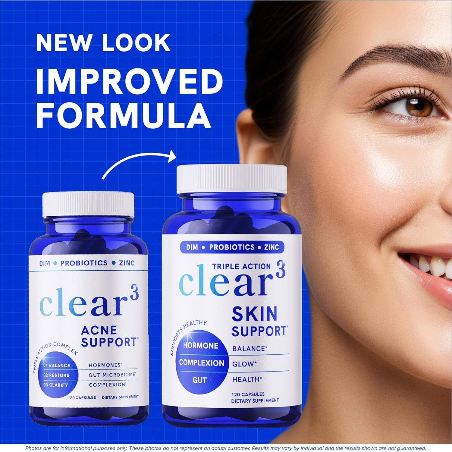 SM Nutrition Clear Acne Support – 120 Capsules | Triple-Action Hormonal, Gut & Skin Nutritional Acne Support