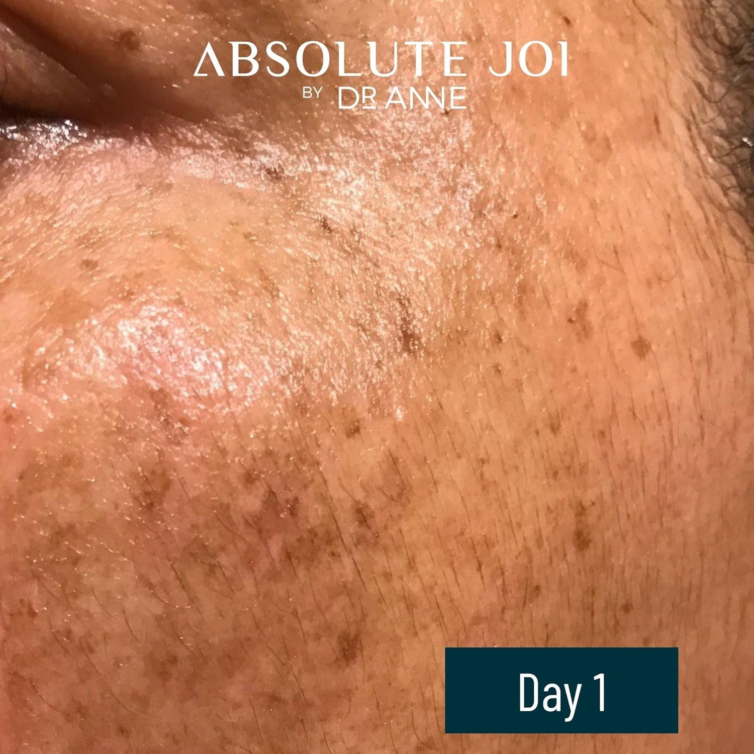 AbsoluteJOI Skin Refining Night Oil – 30ml | Retinol + Vitamin C for Even Tone & Radiant Skin