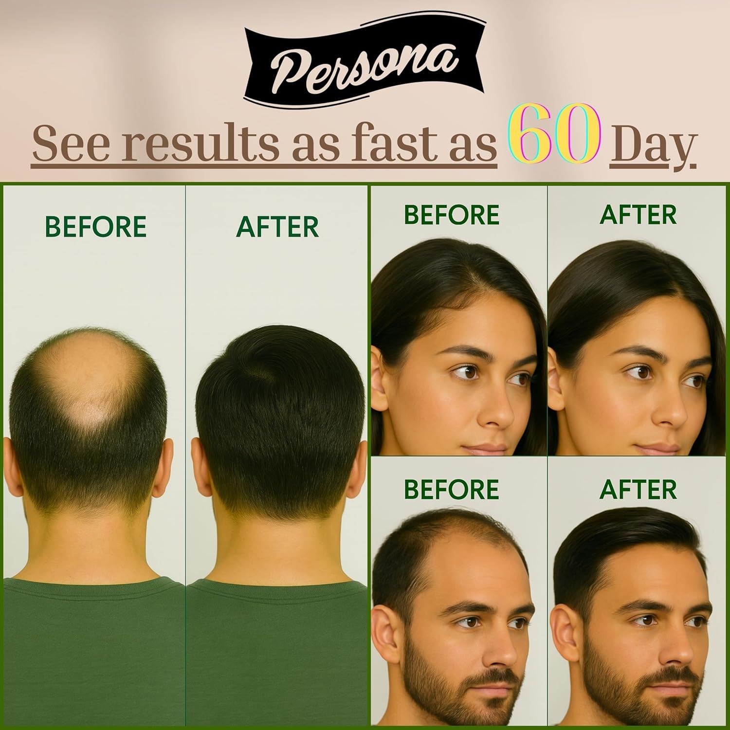 Hair Growth Serum – Advanced Biotin with Caffeine, Peptides, Botanical Extract for Thicker, Fuller, Longer Hair, Reduces Hair Thinning, Hair Regrowth Tonic, Hair Loss Treatment for Men & Women, 30Ml