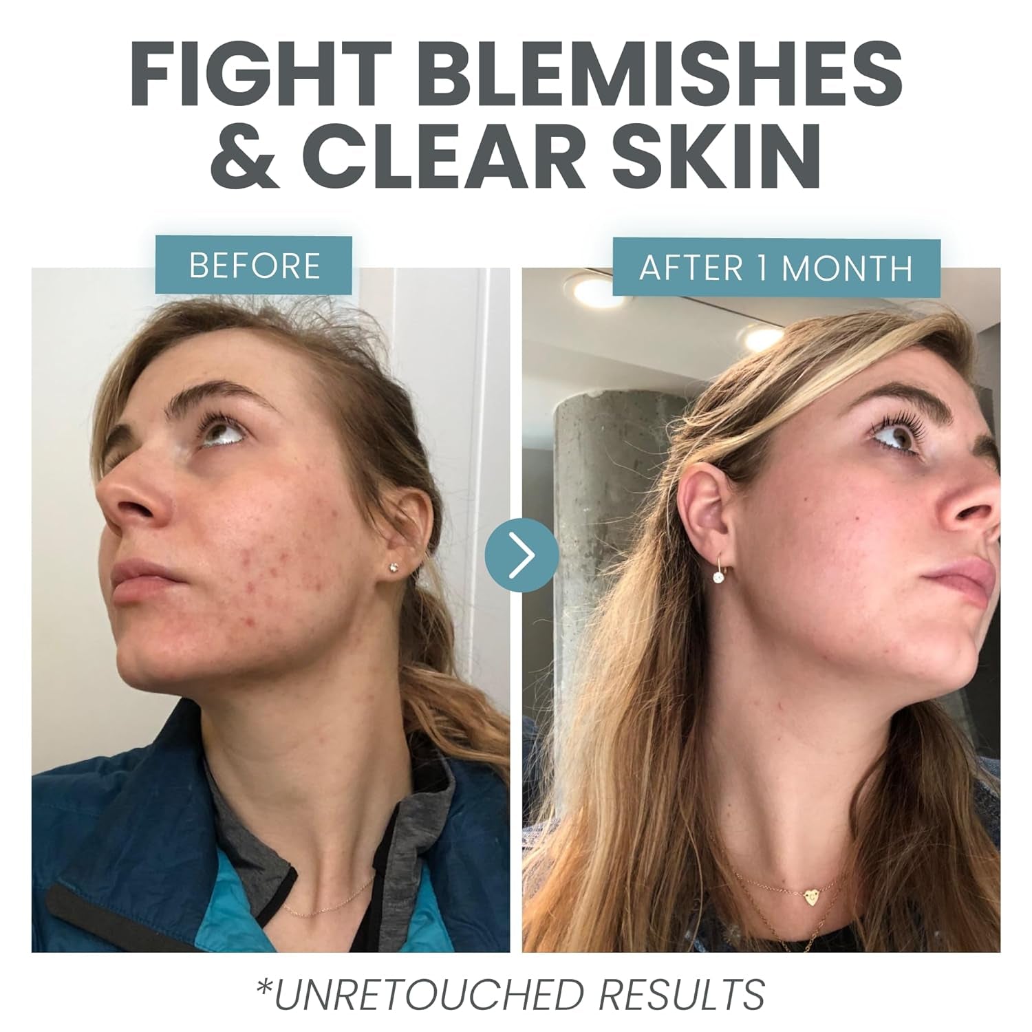 Eva Naturals Vitamin C+ Skin Clearing Serum – 30ml | Anti-Blemish, Pore-Refining & Brightening Face Serum