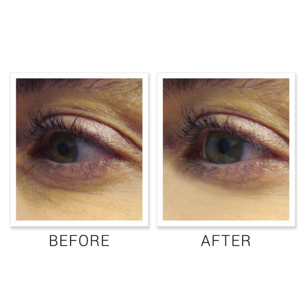 NOVA DERM INSTITUTE EYE DO! Corrective Eye Cream – 15ml | Brightens Dark Circles & Reduces Puffiness