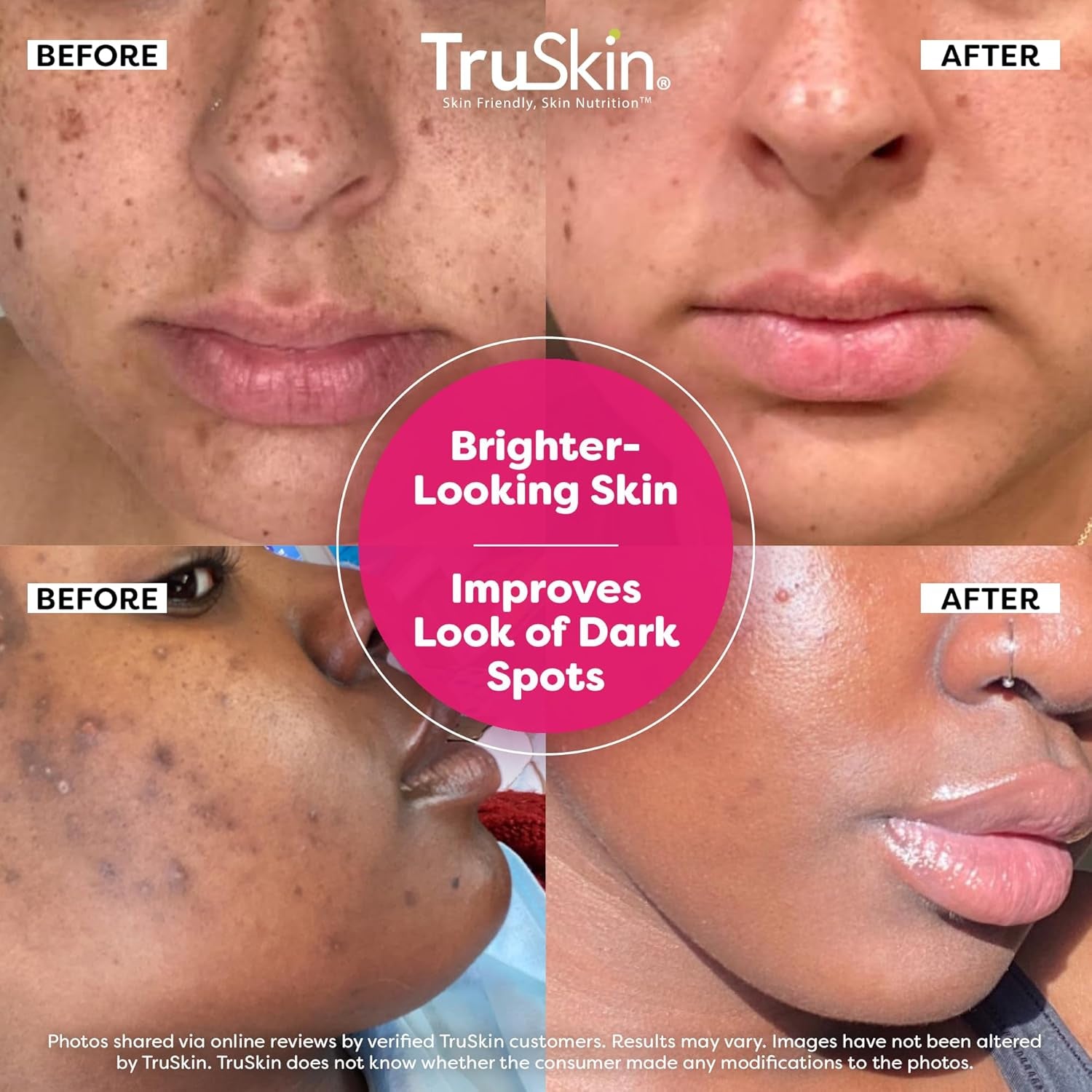 TruSkin C+ Vitamin C Super Serum+ – 60ml | Advanced Anti-Aging & Brightening Face Serum