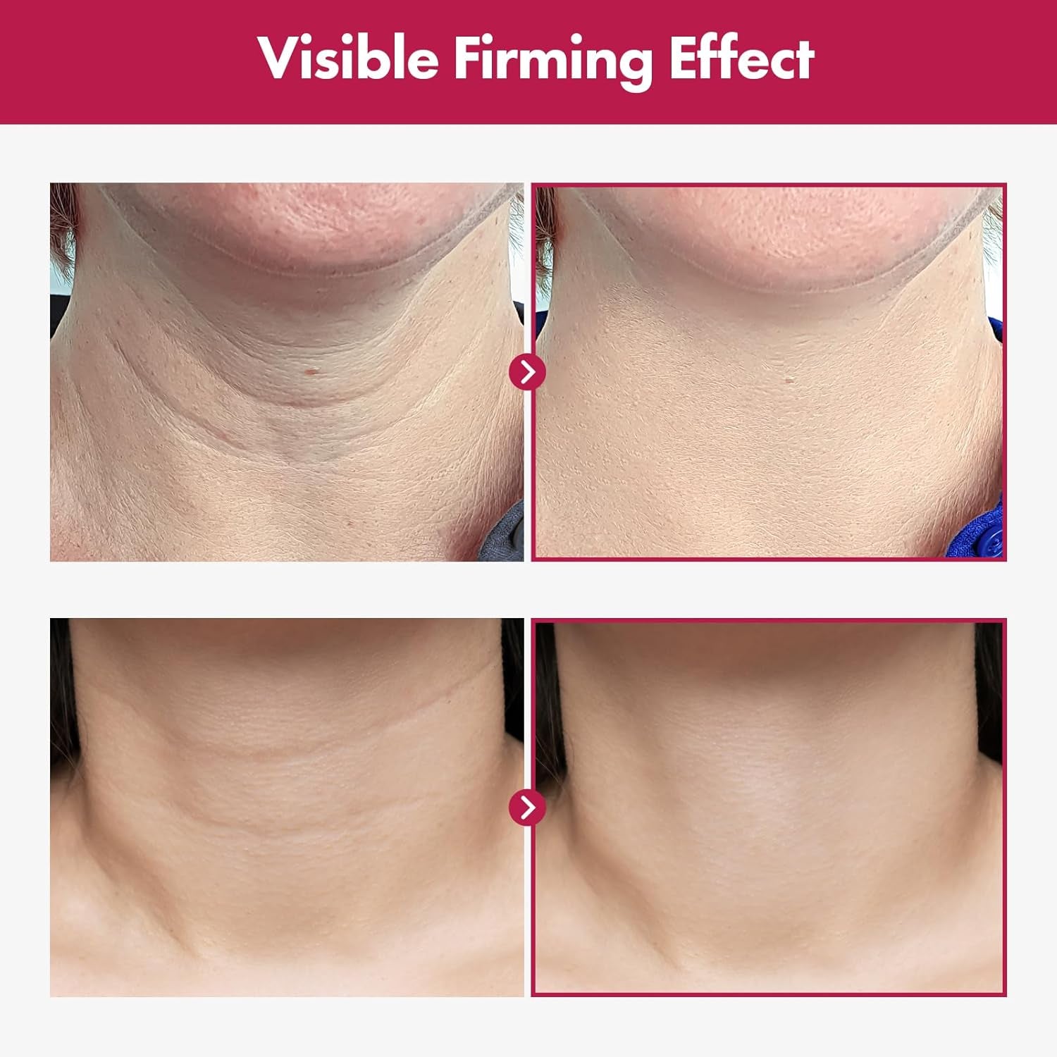 Collagen Necktox Cream with Collagen and Hyaluronic Acid for Neck Firming, Anti-Aging, Wrinkles and Tightening, Korean Skin Care, 50Ml, 1.69 Fl. Oz.