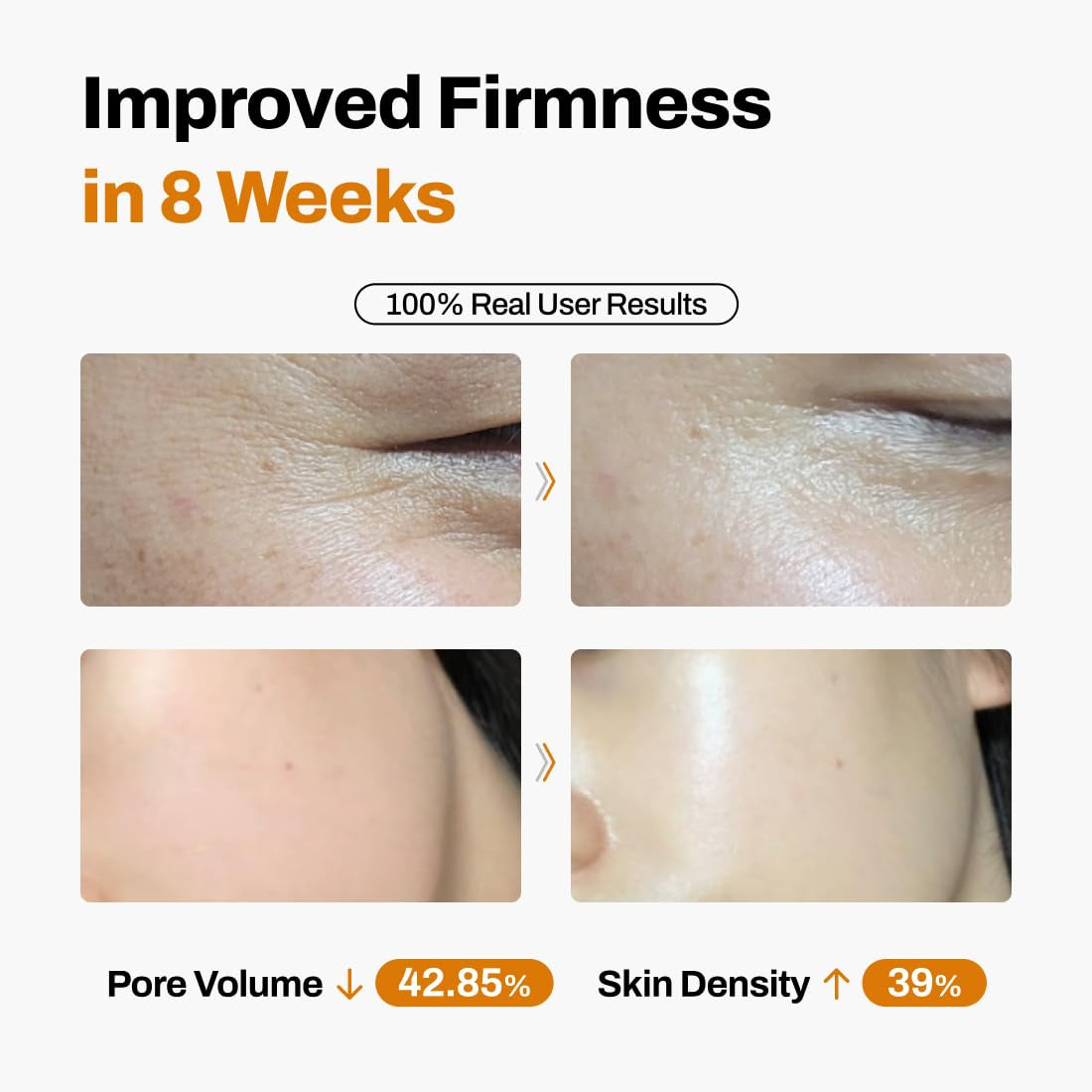 JEU'DEMEURE Dermishuttle Lifting Kit | 8-Week Professional Anti-Aging & Lifting Treatment