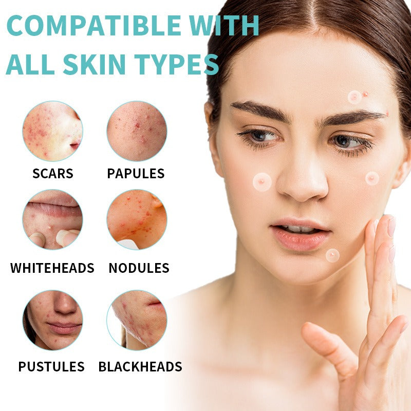 Acne Patch (36 Patches) – Water Gel Transparent Invisible Hydrocolloid Pimple Stickers