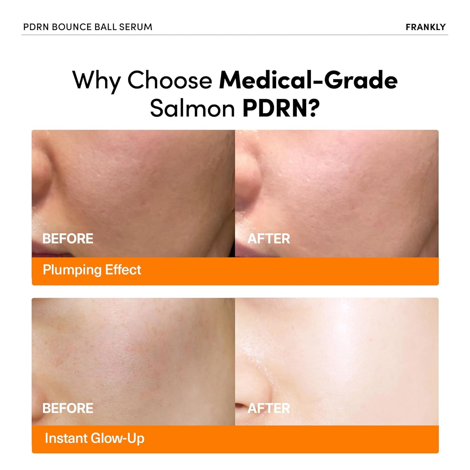 FRANKLY PDRN Bounce Ball Serum – 30ml | Firming, Plumping & Anti-Aging with Salmon DNA Technology