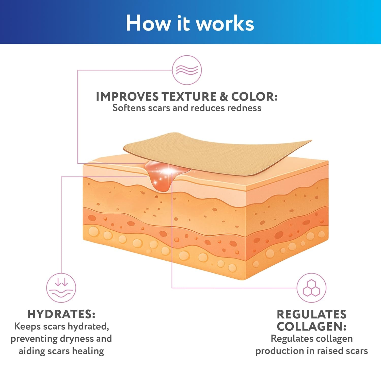 Advanced Silicone Scar Sheets for C-Section, Reusable Strips (1.5” X 7”) for Hypertrophic and Keloid Scars from C-Section & Other Surgeries, 4 Sheets