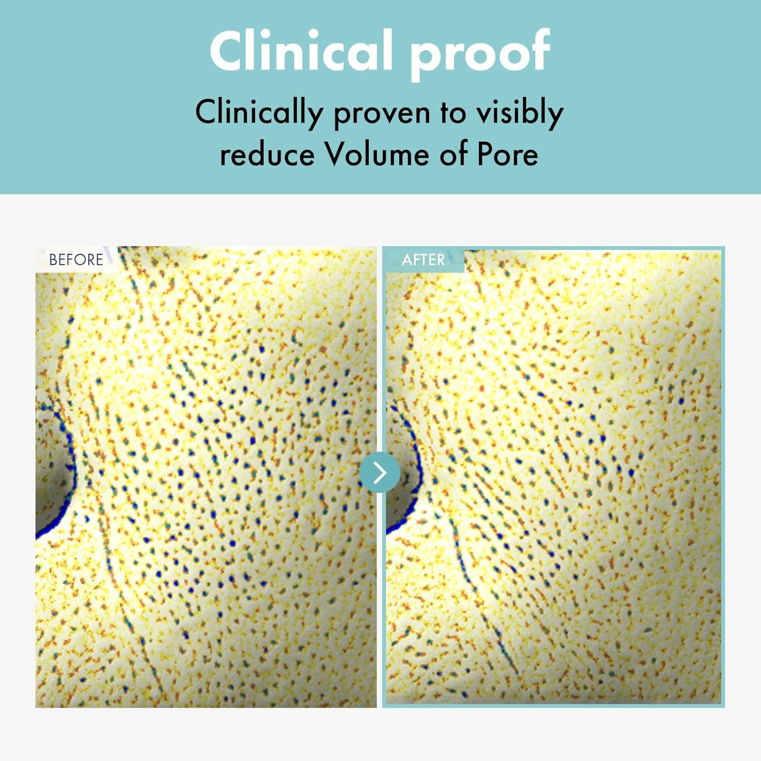 Pore Refiner Cream, Pore Minimizer with AHA - Glycolic Acid and Lactic Acid, Oil Control Face Moisturizer for Oily Skin, Texture Smoothing for Fine Lines, Korean Skincare, 50G / 1.76 Oz.