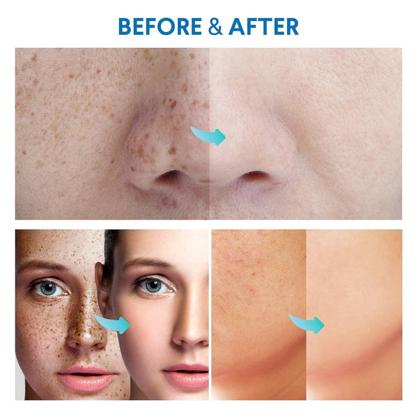 Sielkin Razor Bump Stopper + Dark Spot Remover – 100ml | Smooth, Clear & Even-Toned Skin