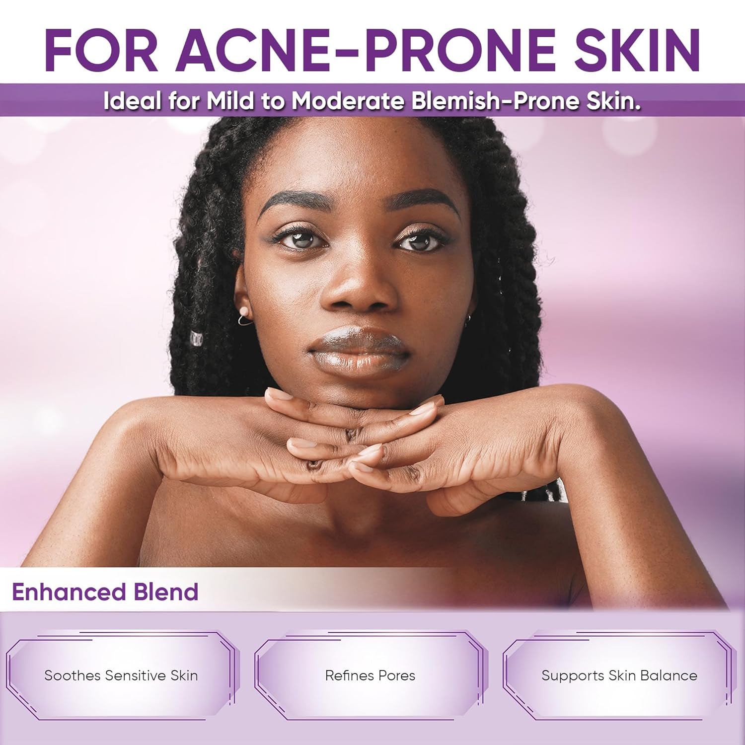 AOBBIY 14% Azelaic Acid Serum – 30ml | Advanced Acne & Redness Relief for Clear, Even Skin