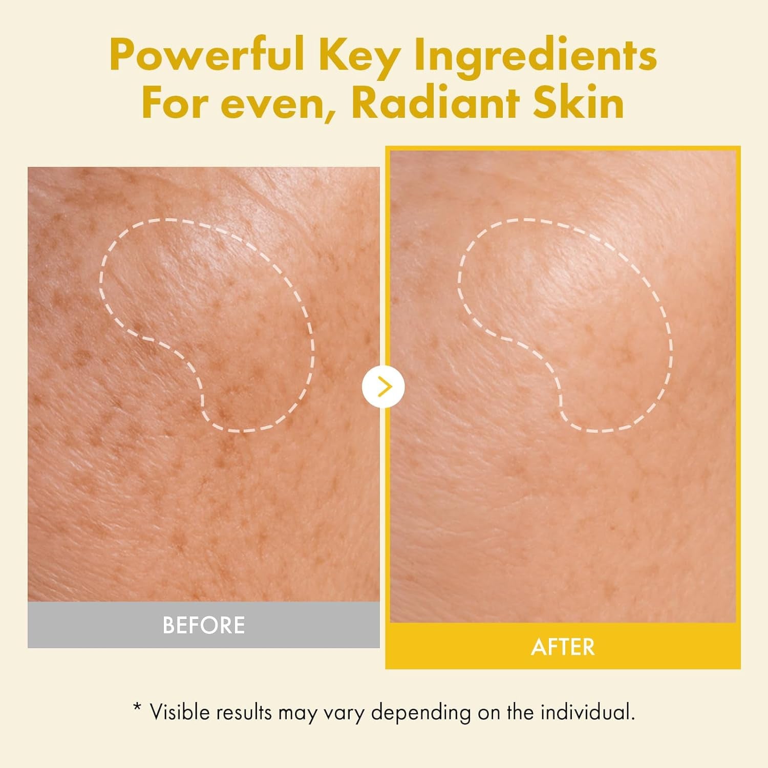 Real Kojic Acid Turmeric Fit, Dark Spot Wrapping Mask, Vitamin C & Glutathione Peel off Facial Mask for Even Tone, Elasticity, Hydrating, Glow, Glass Skin, Korean Skincare, 50Ml/1.69 Fl. Oz.