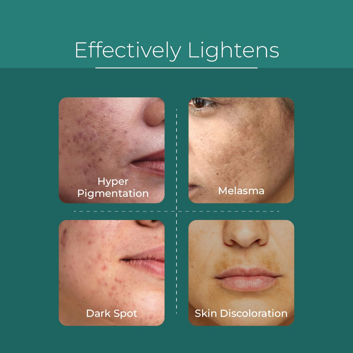 Pure & Cimple Super Clarus Innovative Skin Brightener Serum – 30ml | Dark Spot Corrector for Melasma, Hyperpigmentation & Uneven Skin Tone