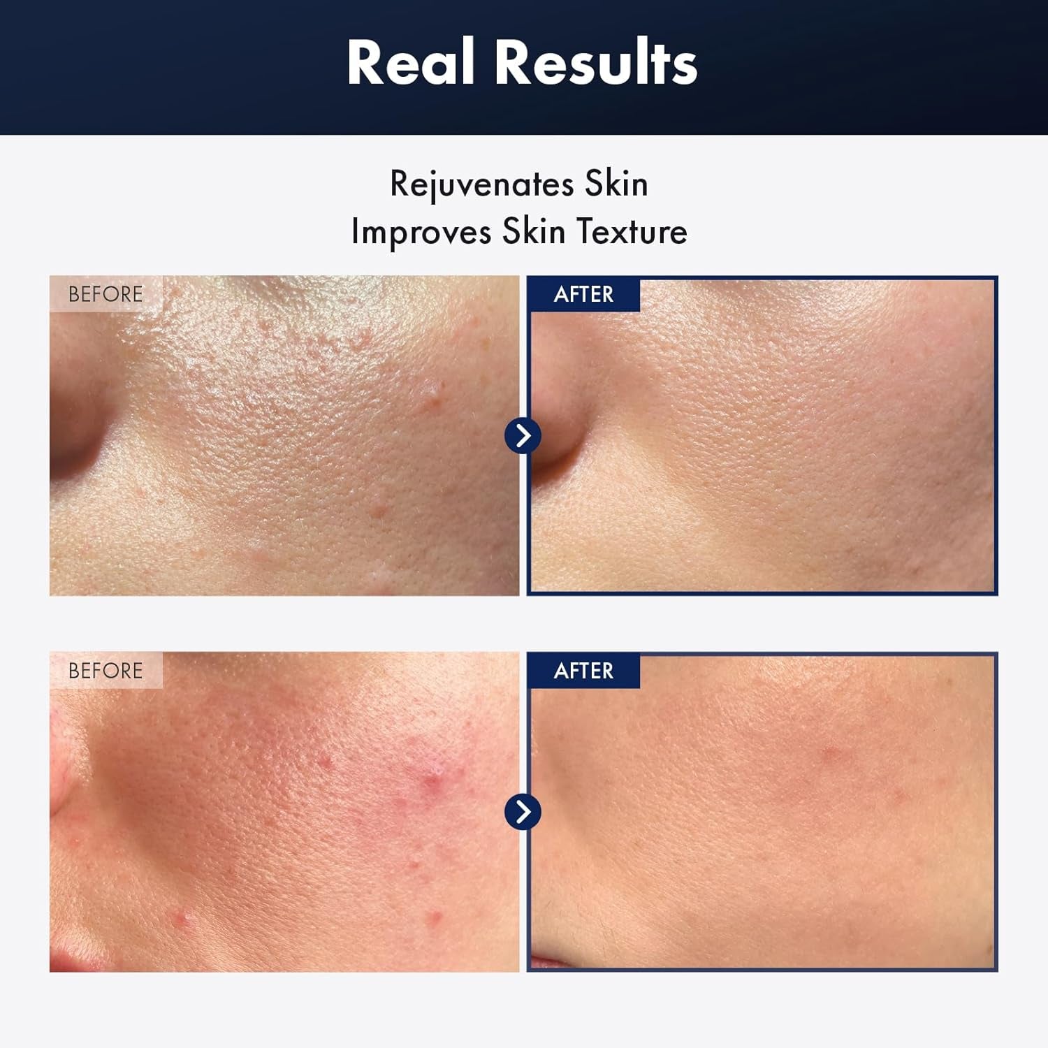 Black Snail plus Essence with 960,890Ppm Black Snail Secretion Filtrate, Hydrating Serum, Repairing, anti Aging, Dull Skin, Fine Lines, Sensitive Skin, Korean Skin Care, 100Ml, 3.38 Fl.Oz.