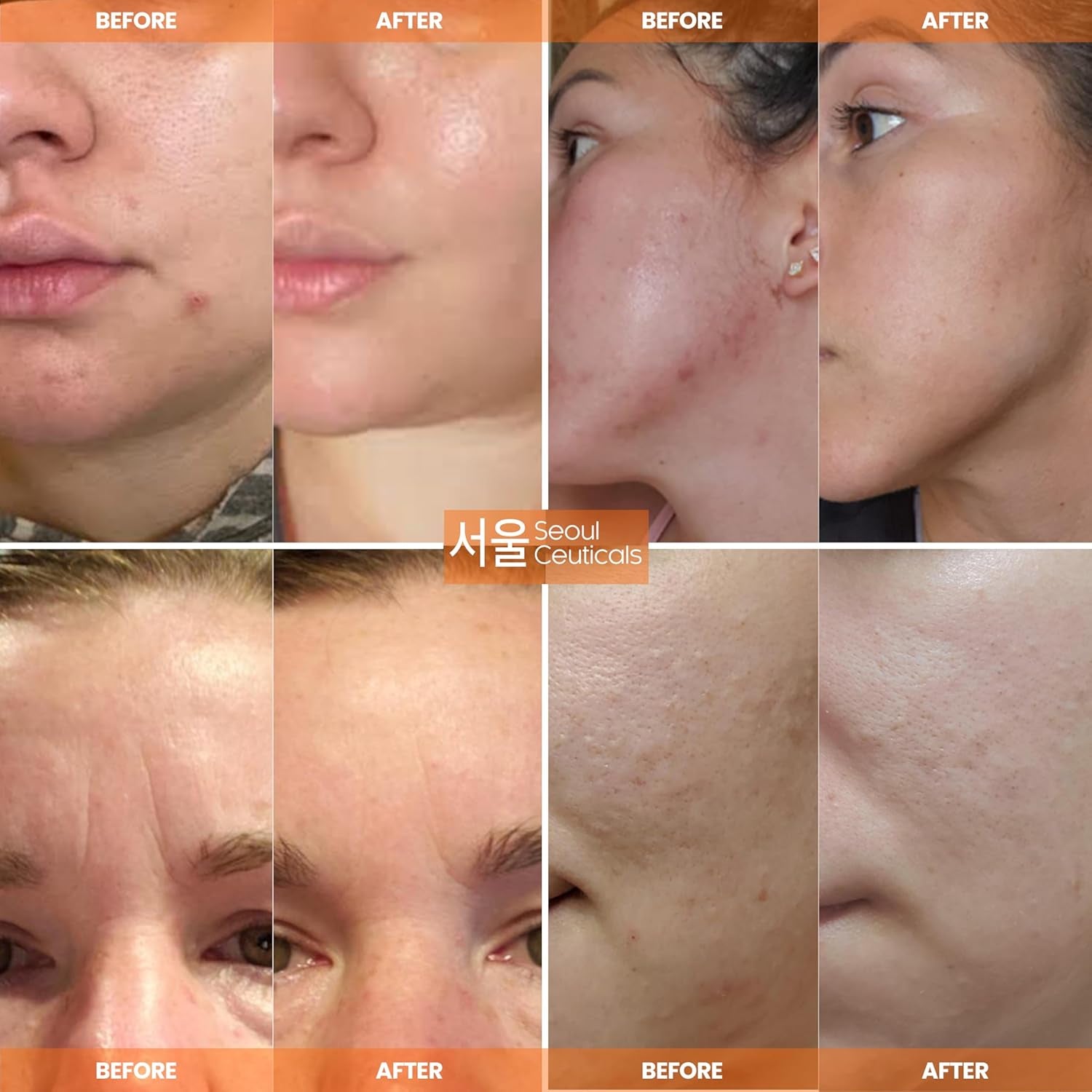 SeoulCeuticals Multi-Function All-In-One Anti-Aging Snail Repair Cream - 120ml (Large Size)