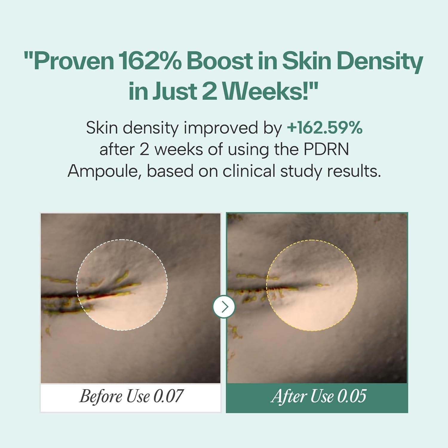 Maybena PDRN 73 Revitalizing Ampoule - 30ml