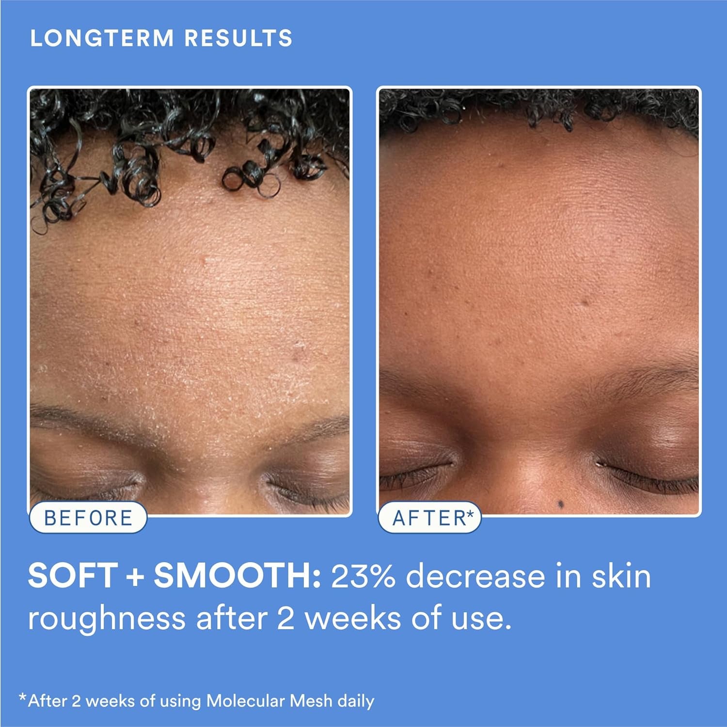 Experiment Molecular Mesh Barrier Strengthening Moisturizer – 60ml | Lightweight Repair & Redness Relief
